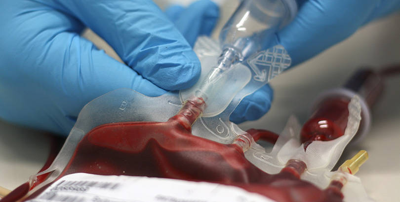 Emotrasfusioni con sangue infetto, il Ministero condannato a risarcire