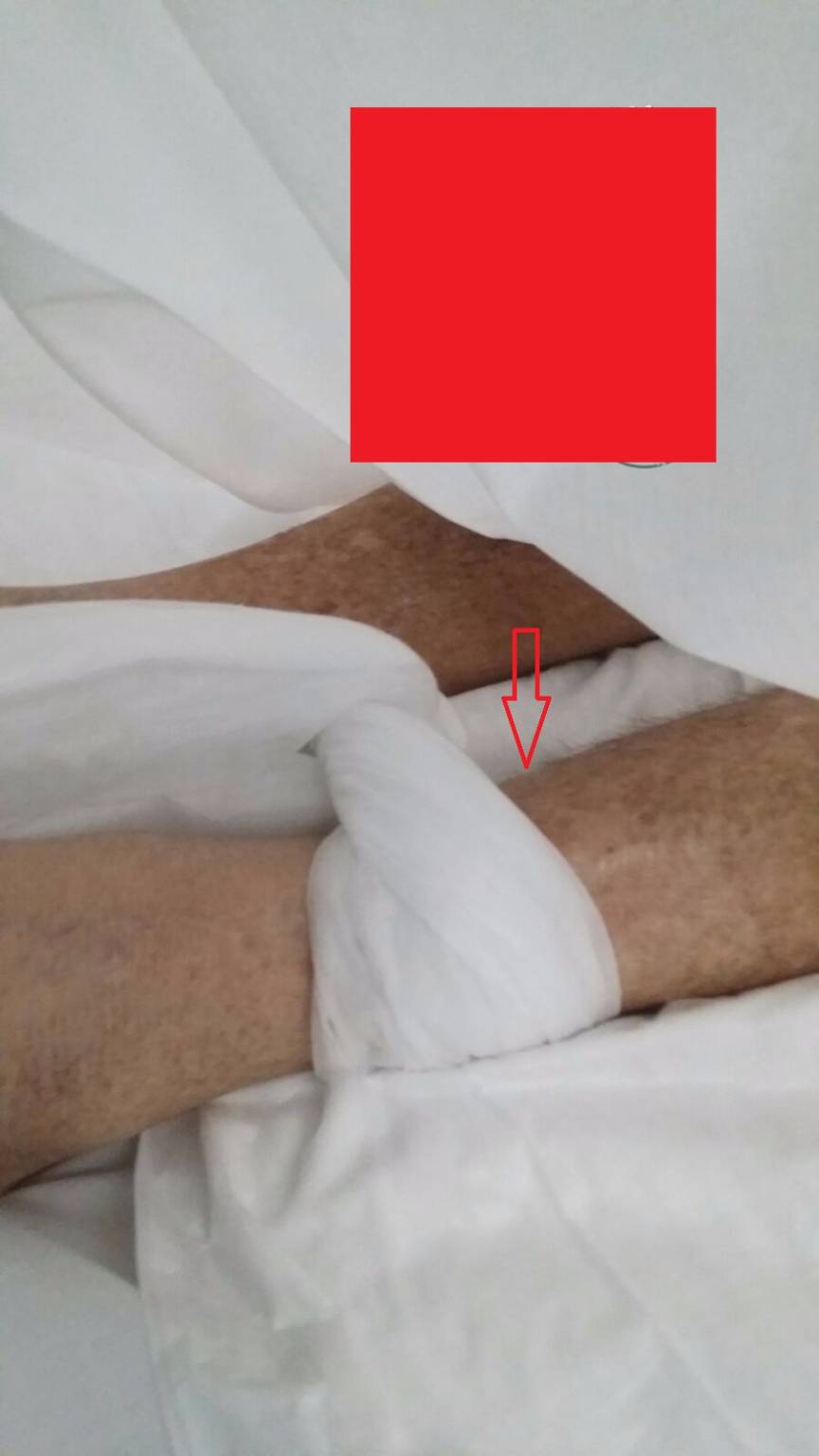 Paziente legato al letto per 14 giorni nell’ospedale di Potenza