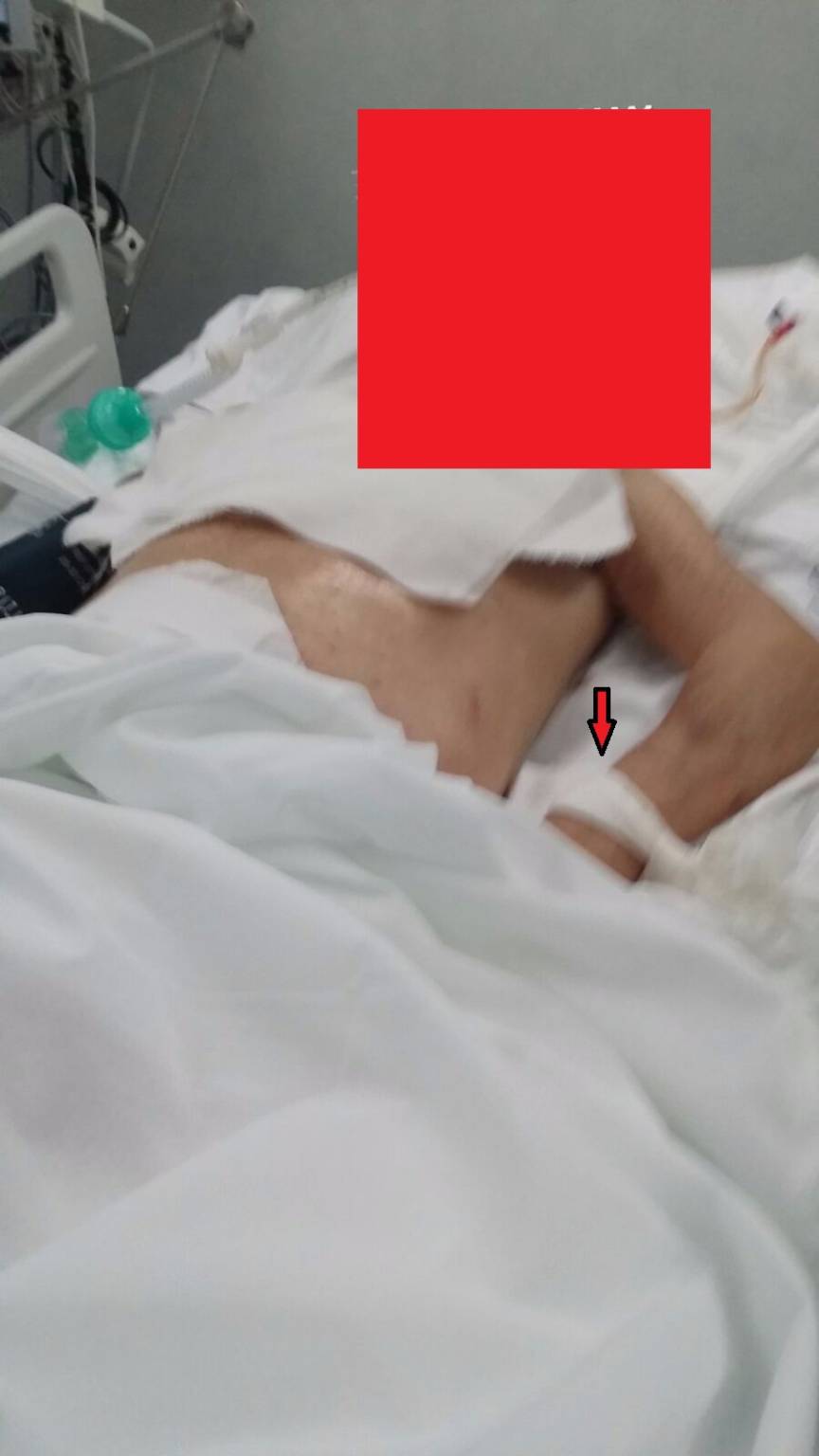 Paziente legato al letto per 14 giorni nell’ospedale di Potenza