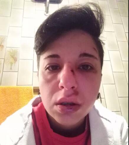 A Potenza, Giulia: picchiata perché lesbica